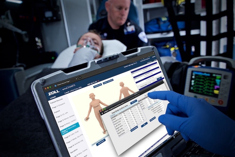 Actionshot-ZOLL-screen-emsCharts_burns_2024-1
