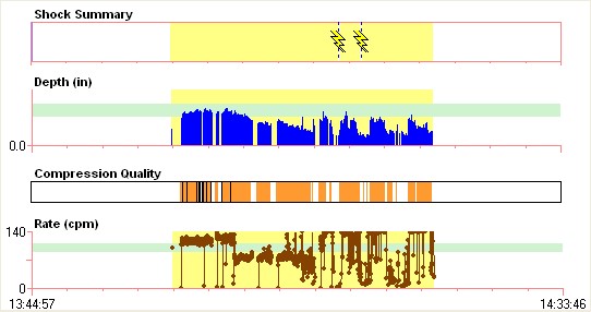 a graph generated by ZOLL Data software to help analyzing CPR data