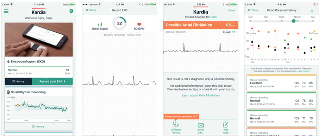 kardia mobile demo